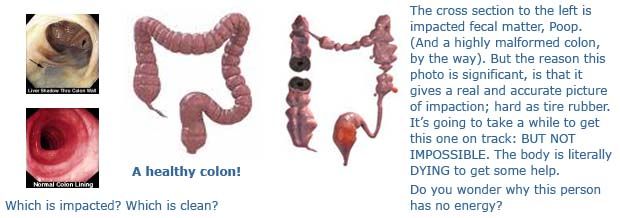 Colon Cleansing